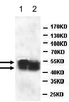 Western blot - Anti-ATP6V1C2 antibody (AB176771)