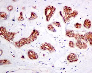 Immunohistochemistry (Formalin/PFA-fixed paraffin-embedded sections) - Anti-ATP6V1D antibody [EPR11326(B)] (AB157458)
