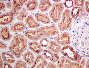 Immunohistochemistry (Formalin/PFA-fixed paraffin-embedded sections) - Anti-ATP6V1D antibody [EPR11326(B)] (AB157458)