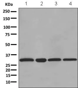 Western blot - Anti-ATP6V1D antibody [EPR11326(B)] (AB157458)