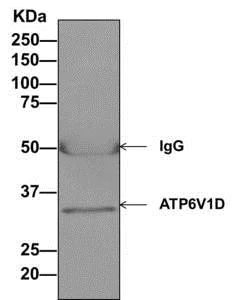 Immunoprecipitation - Anti-ATP6V1D antibody [EPR11326(B)] - BSA and Azide free (AB249327)