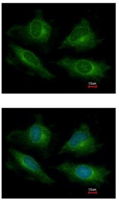 Immunocytochemistry/ Immunofluorescence - Anti-ATP6V1E1 antibody (AB111733), expandable thumbnail
