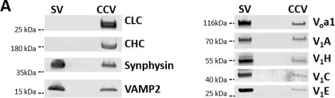 Western blot - Anti-ATP6V1E1 antibody (AB111733)