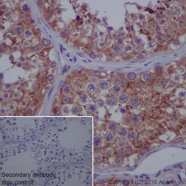 Immunohistochemistry (Formalin/PFA-fixed paraffin-embedded sections) - Anti-ATP6V1E1 antibody [EPR19602] - BSA and Azide free (AB251348)