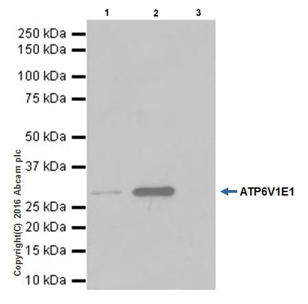 Immunoprecipitation - Anti-ATP6V1E1 antibody [EPR19602] - BSA and Azide free (AB251348)