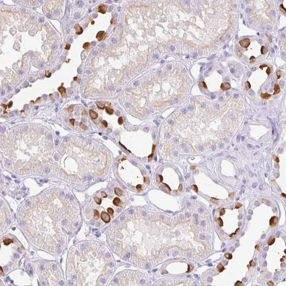 Immunohistochemistry (Formalin/PFA-fixed paraffin-embedded sections) - Anti-ATP6V1G3 antibody (AB122012)