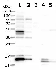 Western blot - Anti-ATP6V1G3 antibody (AB122012)