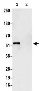Immunoprecipitation - Anti-ATP6V1H antibody (AB187706)