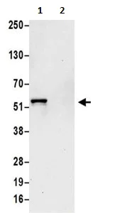 Immunoprecipitation - Anti-ATP6V1H antibody (AB187706)