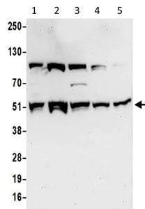 Western blot - Anti-ATP6V1H antibody (AB187706)