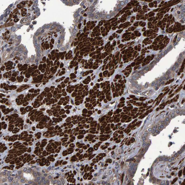 Immunohistochemistry (Formalin/PFA-fixed paraffin-embedded sections) - Anti-ATP6V1H antibody (AB254685)