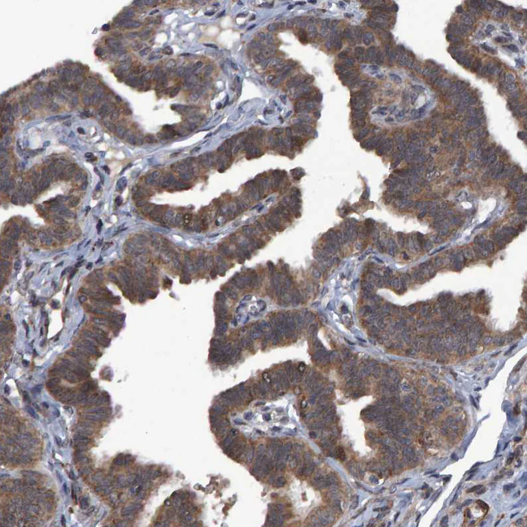 Immunohistochemistry (Formalin/PFA-fixed paraffin-embedded sections) - Anti-ATP6V1H antibody (AB254685)