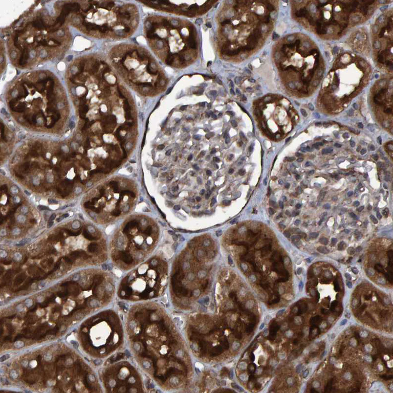 Immunohistochemistry (Formalin/PFA-fixed paraffin-embedded sections) - Anti-ATP6V1H antibody (AB254685)