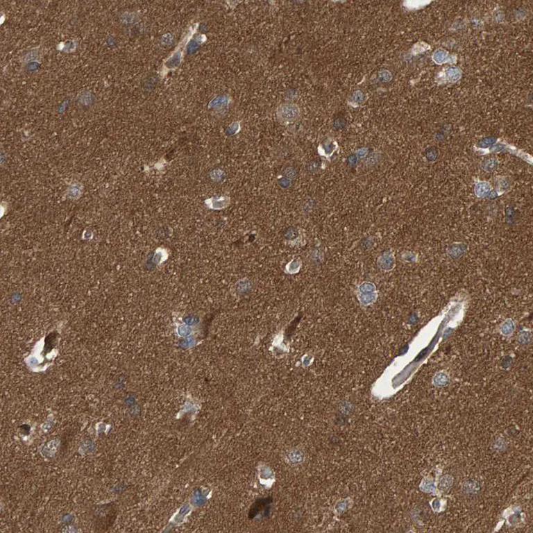 Immunohistochemistry (Formalin/PFA-fixed paraffin-embedded sections) - Anti-ATP6V1H antibody (AB254685)