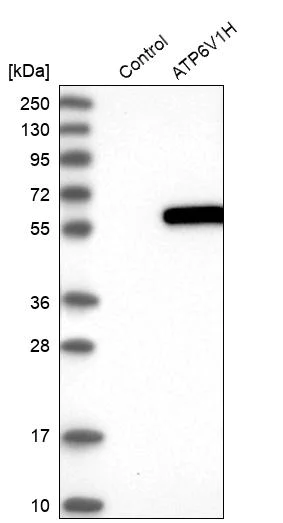 Western blot - Anti-ATP6V1H antibody (AB254685)