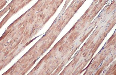 Immunohistochemistry paraffin embedded sections - Anti-ATP6V1H antibody [HL1316] (AB308579), expandable thumbnail