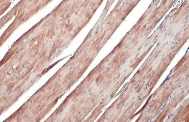 Immunohistochemistry paraffin embedded sections - Anti-ATP6V1H antibody [HL1316] (AB308579)