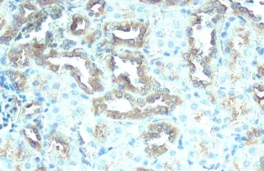 Immunohistochemistry paraffin embedded sections - Anti-ATP6V1H antibody [HL1316] (AB308579)