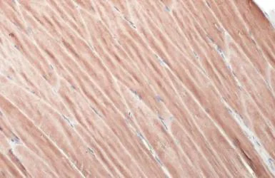 Immunohistochemistry paraffin embedded sections - Anti-ATP6V1H antibody [HL1316] (AB308579)