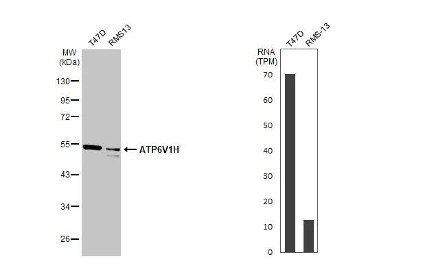 Western blot - Anti-ATP6V1H antibody [HL1316] (AB308579)