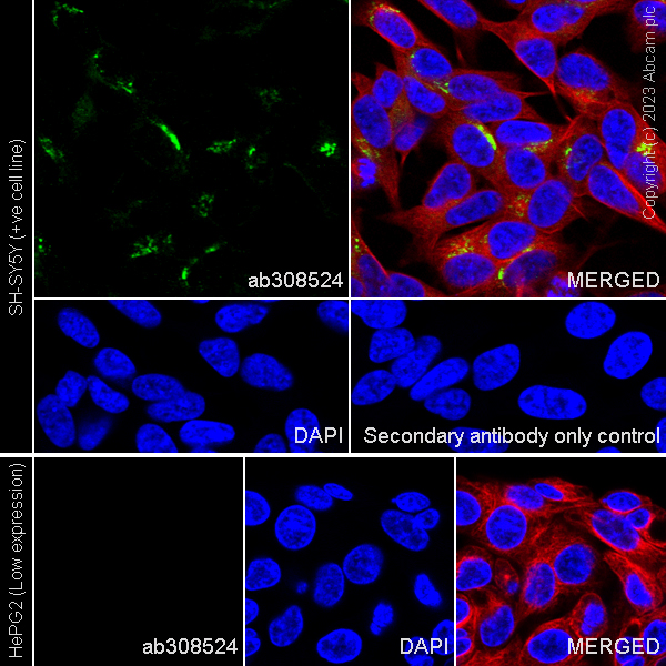 Immunocytochemistry/ Immunofluorescence - Anti-ATP7A antibody [EPR27493-139] (AB308524)