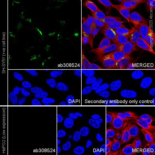 Immunocytochemistry/ Immunofluorescence - Anti-ATP7A antibody [EPR27493-139] - BSA and Azide free (AB308525)