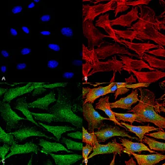 Immunocytochemistry/ Immunofluorescence - Anti-ATP7A antibody [L60/4] (AB131400)