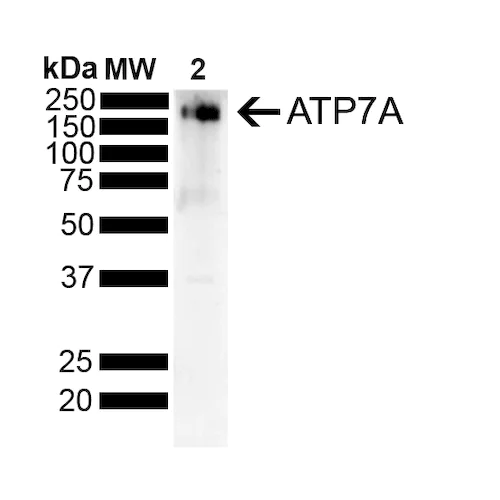 Western blot - Anti-ATP7A antibody [L60/4] (AB131400)