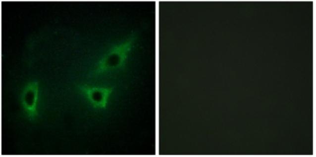 Immunocytochemistry/ Immunofluorescence - Anti-ATP7b antibody (AB133731)