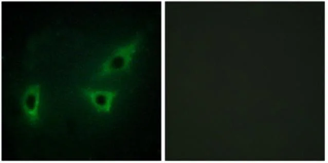 Immunocytochemistry/ Immunofluorescence - Anti-ATP7b antibody (AB133731)