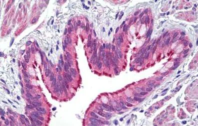 Immunohistochemistry (Formalin/PFA-fixed paraffin-embedded sections) - Anti-ATP7b antibody (AB133731)
