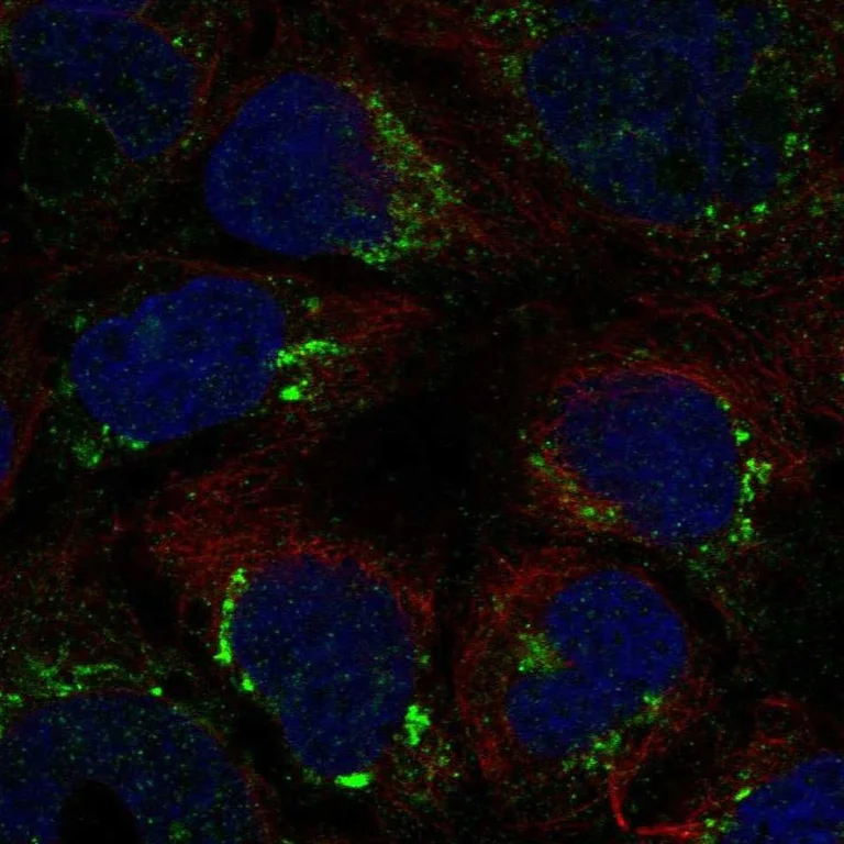 Immunocytochemistry/ Immunofluorescence - Anti-ATP7b antibody (AB262897)