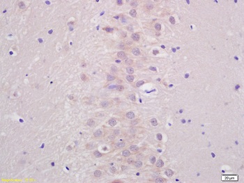 Immunohistochemistry (Formalin/PFA-fixed paraffin-embedded sections) - Anti-ATP7b antibody - C-terminal (AB217299)