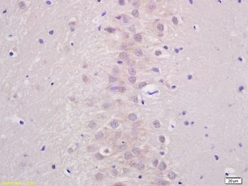 Immunohistochemistry (Formalin/PFA-fixed paraffin-embedded sections) - Anti-ATP7b antibody - C-terminal (AB217299)