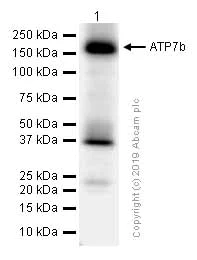 Western blot - Anti-ATP7b antibody [EPR6793] (AB131208)