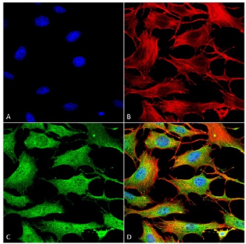 Immunocytochemistry/ Immunofluorescence - Anti-ATP7b antibody [S62-29] - N-terminal (AB240880), expandable thumbnail