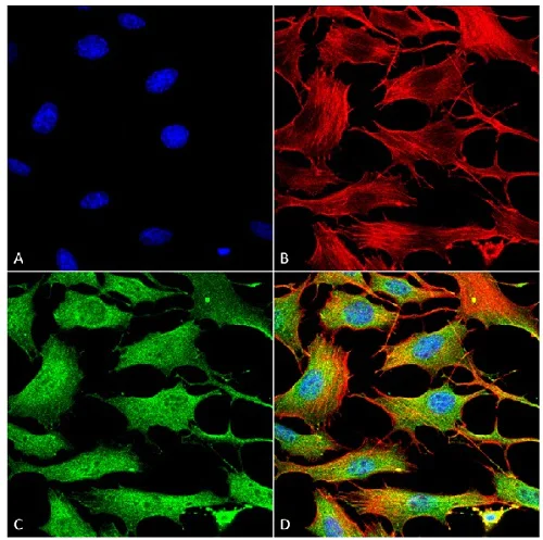 Immunocytochemistry/ Immunofluorescence - Anti-ATP7b antibody [S62-29] - N-terminal (AB240880)