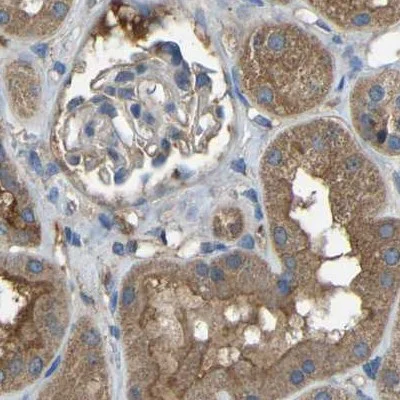 Immunohistochemistry (Formalin/PFA-fixed paraffin-embedded sections) - Anti-ATP8B1 antibody (AB121576)
