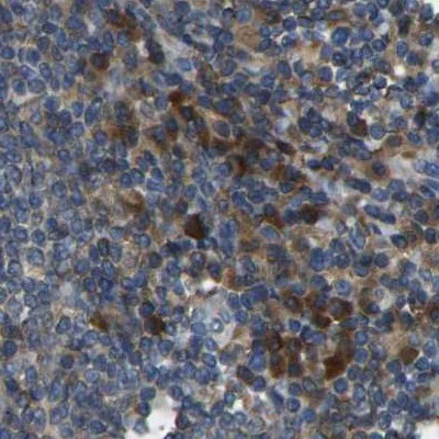 Immunohistochemistry (Formalin/PFA-fixed paraffin-embedded sections) - Anti-ATP8B1 antibody (AB121576)