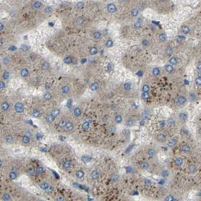 Immunohistochemistry (Formalin/PFA-fixed paraffin-embedded sections) - Anti-ATP8B1 antibody (AB121576)