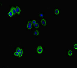 Immunocytochemistry/ Immunofluorescence - Anti-ATP8B1 antibody (AB234761)