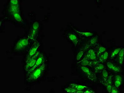 Immunocytochemistry/ Immunofluorescence - Anti-ATP9A antibody (AB234873)