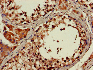Immunohistochemistry (Formalin/PFA-fixed paraffin-embedded sections) - Anti-ATP9A antibody (AB234873), expandable thumbnail