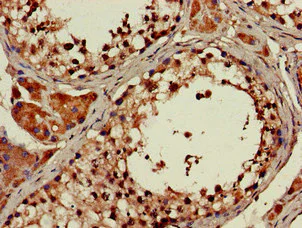 Immunohistochemistry (Formalin/PFA-fixed paraffin-embedded sections) - Anti-ATP9A antibody (AB234873)