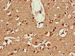 Immunohistochemistry (Formalin/PFA-fixed paraffin-embedded sections) - Anti-ATP9A antibody (AB234873), expandable thumbnail