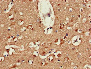Immunohistochemistry (Formalin/PFA-fixed paraffin-embedded sections) - Anti-ATP9A antibody (AB234873)