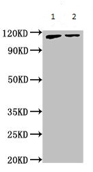 Western blot - Anti-ATP9A antibody (AB234873), expandable thumbnail