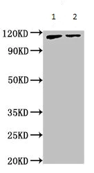Western blot - Anti-ATP9A antibody (AB234873)