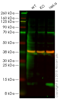 Western blot - Anti-ATPase Inhibitory Factor 1/IF1 antibody [5E2D7] (AB110277)