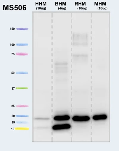 Western blot - Anti-ATPase Inhibitory Factor 1/IF1 antibody [5E2D7] (AB110277)